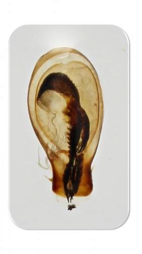 Xantholinus gallicus